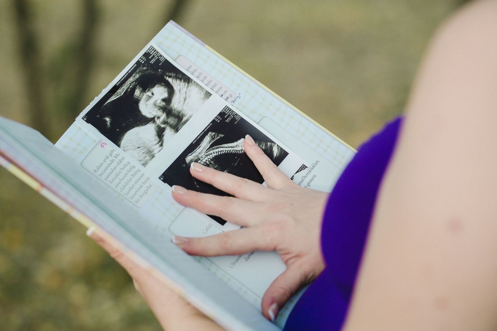 A hand resting on an ultrasound photo in an open album